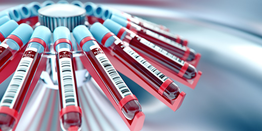 がん腫瘍化前検査